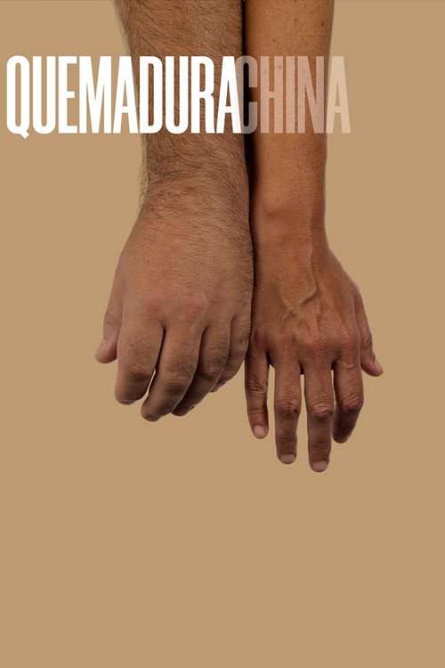 Quemadura china poster