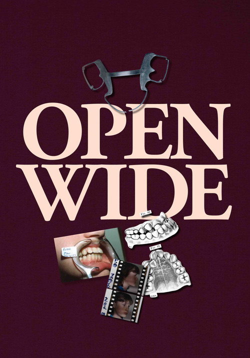 Open Wide trailer
