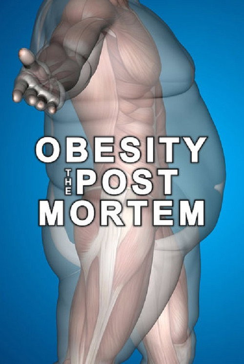 Obesity: The Post Mortem trailer